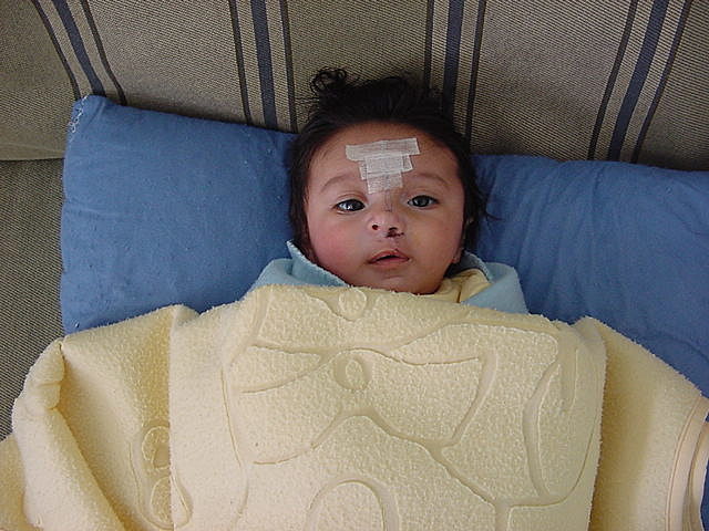 Primer cirugía de Emiliano