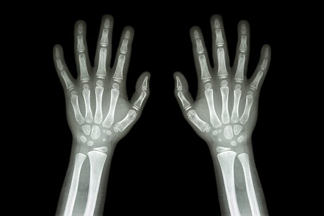 1953: Esta fecha representa un momento culminante. James Watson y Francis Crick interpretan los datos de difracción de rayos X de Rosalind Franklin y Maurice Wilkins