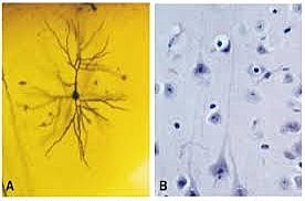 Camillo Golgi medico italiano publica sus trabajos sobre el método de tinción del nitrato de plata