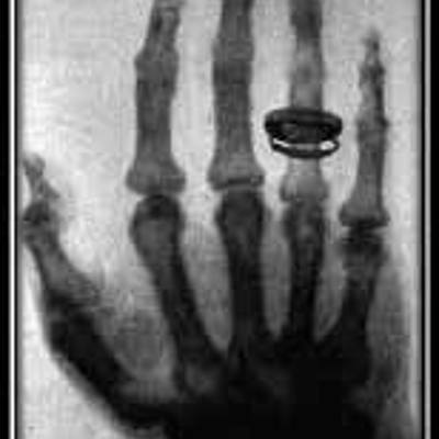 Timeline: Historia de la Radiología