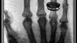 Timeline: Historia de la Radiología