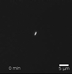 1996 Bacteria Escherichia Coli