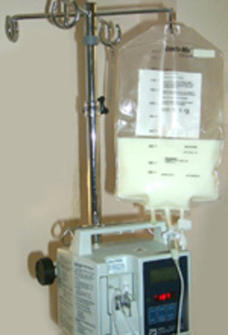 Development of Total Parenteral Nutrition