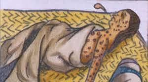 Indigenous gets smallpox