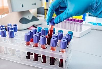 Normas de calidad en pruebas de laboratorio