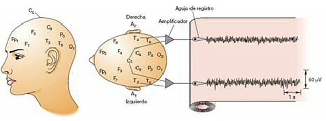 Otto Fiedric Dieters 1834-1863 - Hans Berger 1873-1941