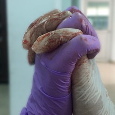 Timeline: MEDICINA Y GUERRA