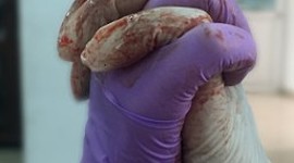 Timeline: MEDICINA Y GUERRA