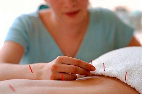 Técnico Superior en Acupuntura