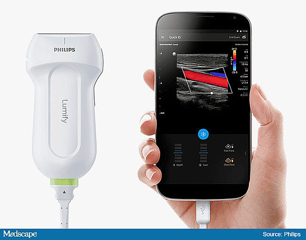 Ecógrafo en un Smartphone.