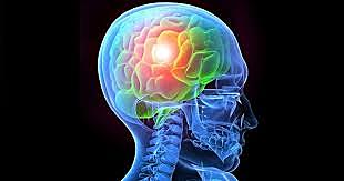 premisas del cerebro