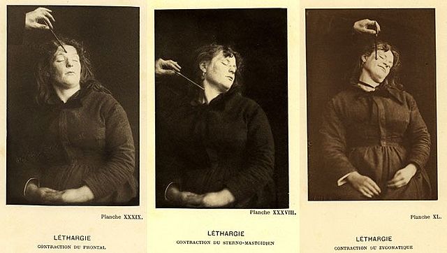 Charcot y la hipnosis.