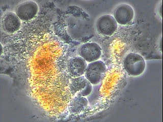 J. Jacobson propuso el ácido crómico