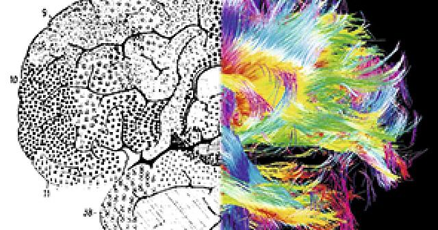 Primeras intervenciones del cerebro