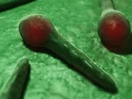 Reportan casos de Tetanos.