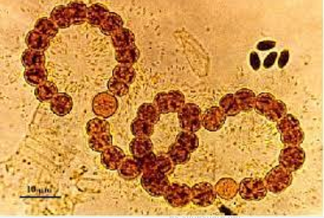 La teoría microbiana