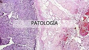 la patología (disease)