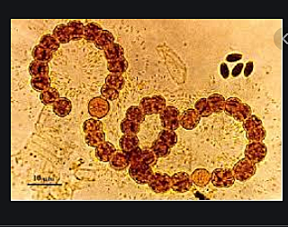 Surgimiento de la teoría microbiana