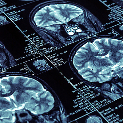 Timeline: Historia de la Resonancia Magnética =D
