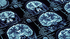 Timeline: Historia de la Resonancia Magnética =D