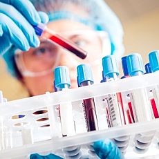 Tonks.- Normas de Calidad