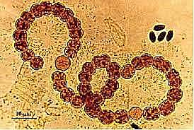Surgimiento de la teoría microbiana