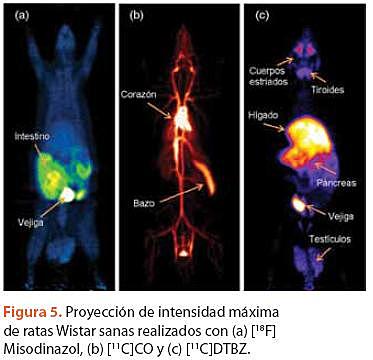 Diferencias en los espectros de resonancia de los electrones