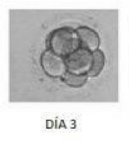 Dia 3