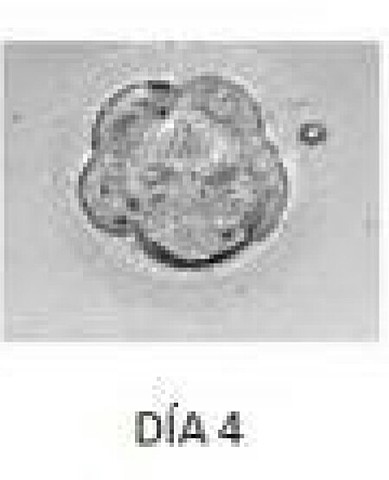 Dia 4