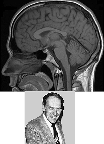 ERICK ODEBLAD- MIDE LA SEÑAL DE RESONANCIA EN TEJIDOS HUMANOS