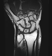 PUBLICACIÓN IMÁGENES RM DE MUÑECA