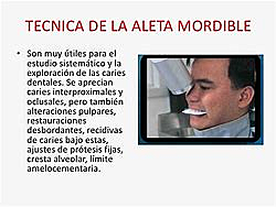 Tecnica de aleta mordible