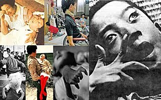 Enfermedad de Minamata