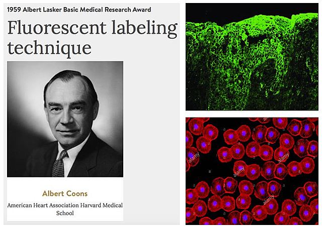 Desarrollo de la técnica de inmunofluorescencia