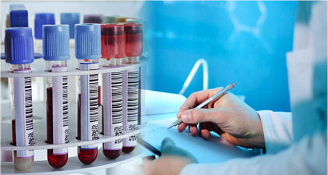 Control de calidad en los laboratorios clínicos