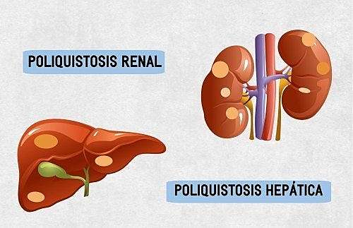 Las diferencias en los espectros de resonancia de los electrones