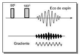 Las medidas de resonancia: Spin-Eco
