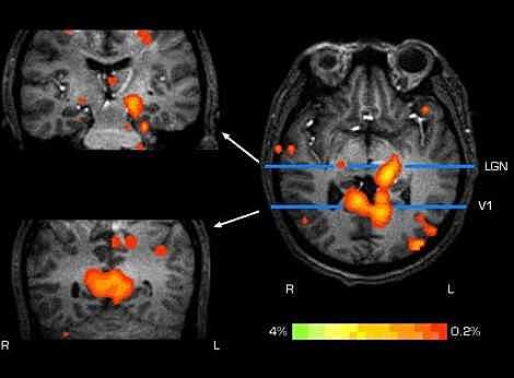 ZEUGMATOGRAFIA:El avance fundamental para la medicina