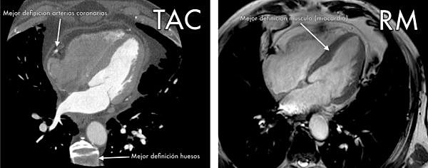 Imágenes RM está sustentada en la de la tomografía computada