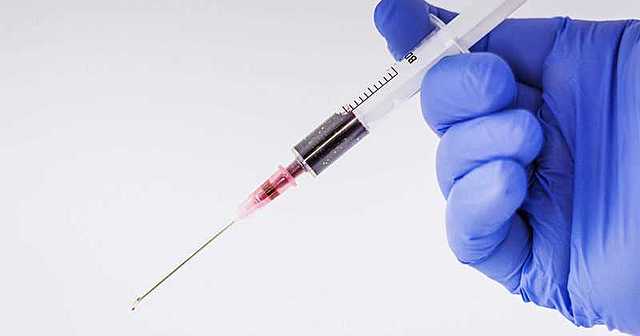 Métodos neuroquímicos