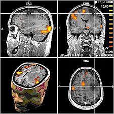 La base de la formación actual de imágenes de RM