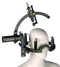 Lesiones excitotóxicas