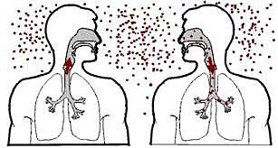 Control de la Tuberculosis