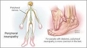 MEDICINA NATURAL- Naturopatia