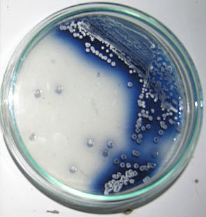 Secuenciación del genoma de Streptomyces Coelicolor