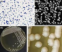 superbacteria resistente a todos los antibióticos conocidos Staphylococcus epidermidis