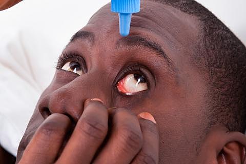 Lanzamiento del Programa de Lucha contra la Oncocercosis