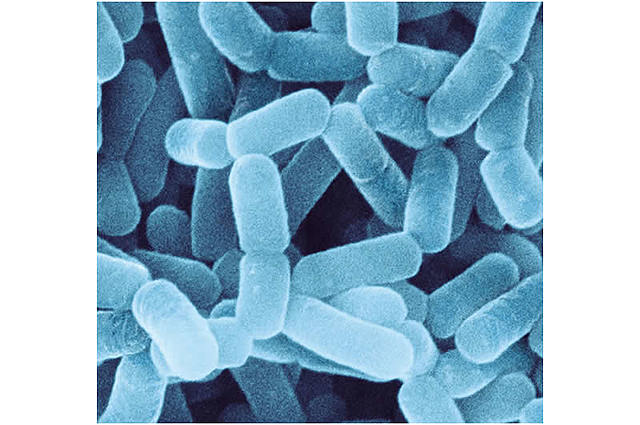 descubrimiento de lactobacillus casei