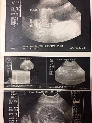 Una oportunidad para cambio en mi vida y en la de los demás