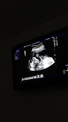 Embarazo de mi mamá